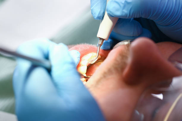Best Walk-In Emergency Dentist in Austin, TX